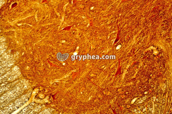 Moelle épinière x40 - gryphea.com